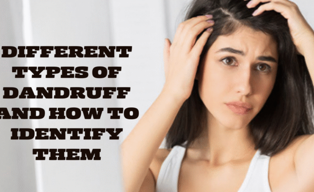 Different Types of Dandruff and How to Identify Them