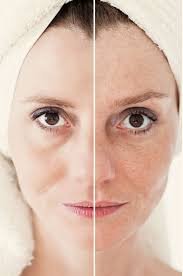 Supports Skin Barrier and Elasticity